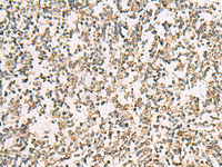 Immunohistochemistry of paraffin-embedded Human tonsil tissue using ZPBP2 Polyclonal Antibody at dilution of 1:50 (×200)