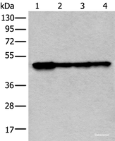 Western blot analysis of 293T and 231 cell lysates using VRK1 Polyclonal Antibody at dilution of 1:400