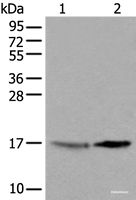Western blot analysis of 231 cell and Human cerebrum tissue lysates using UBE2W Polyclonal Antibody at dilution of 1:550