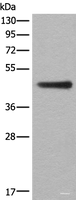 Western blot analysis of A431 cell lysate using ASS1 Polyclonal Antibody at dilution of 1:300