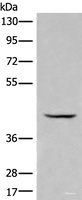 Western blot analysis of Human kidney tissue lysate using BBOX1 Polyclonal Antibody at dilution of 1:650