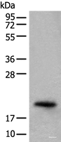 Western blot analysis of Mouse eye tissue lysate using CRYGS Polyclonal Antibody at dilution of 1:800