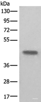 Western blot analysis of Human kidney tissue lysate using BHMT2 Polyclonal Antibody at dilution of 1:450