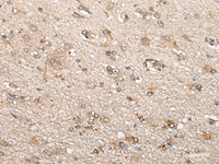 Immunohistochemistry of paraffin-embedded Human brain tissue using BCHE Polyclonal Antibody at dilution of 1:60 (×200)