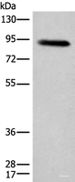 Western blot analysis of Human plasma solution using C1R Polyclonal Antibody at dilution of 1:800