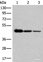 Western blot analysis of HEPG2 Hela and A549 cell lysates using NADK2 Polyclonal Antibody at dilution of 1:600