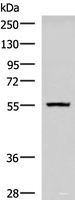 Western blot analysis of Human cerebella tissue lysate using CAMKK1 Polyclonal Antibody at dilution of 1:700