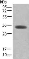 Western blot analysis of Mouse skeletal muscle tissue lysate using MYOZ2 Polyclonal Antibody at dilution of 1:450