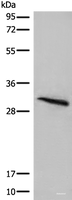 Western blot analysis of Mouse lung tissue lysate using ITM2B Polyclonal Antibody at dilution of 1:400