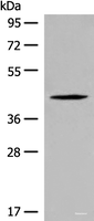 Western blot analysis of Jurkat cell lysate using QTRT1 Polyclonal Antibody at dilution of 1:450