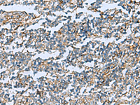 Immunohistochemistry of paraffin-embedded Human tonsil tissue using DPYSL3 Polyclonal Antibody at dilution of 1:55 (×200)