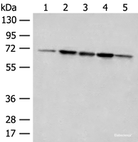 Western blot analysis of 293T cell Rat liver tissue A172 and Jurkat cell lysates using ACSF2 Polyclonal Antibody at dilution of 1:400
