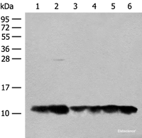 Western blot analysis of 293T cell Human fetal liver tissue lysates using ATP5L Polyclonal Antibody at dilution of 1:500