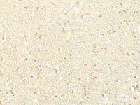 Immunohistochemistry of paraffin-embedded Human brain tissue using SPIRE1 Polyclonal Antibody at dilution of 1:60 (×200)