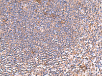 Immunohistochemistry of paraffin-embedded Human tonsil tissue using PDRG1 Polyclonal Antibody at dilution of 1:80 (×200)