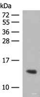 Western blot analysis of Human plasma solution using HBG1:HBG2 Polyclonal Antibody at dilution of 1:350