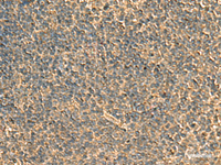 Immunohistochemistry of paraffin-embedded Human tonsil tissue using RPS11 Polyclonal Antibody at dilution of 1:40 (×200)