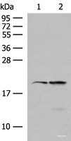 Western blot analysis of 293T and Jurkat cell lysates using RNF5 Polyclonal Antibody at dilution of 1:250