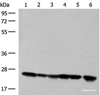 Western blot analysis of 293T cell and Human fetal liver tissue lysates using DTYMK Polyclonal Antibody at dilution of 1:550