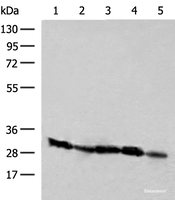 Western blot analysis of Raji Jurkat K562 and 231 cell Human kidney tissue lysates using CD48 Polyclonal Antibody at dilution of 1:250