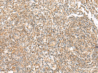 Immunohistochemistry of paraffin-embedded Human tonsil tissue using ORC4 Polyclonal Antibody at dilution of 1:70 (×200)