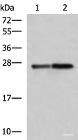 Western blot analysis of Mouse pancreas tissue and Rat pancreas tissue lysates using CTRB1 Polyclonal Antibody at dilution of 1:1000