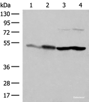 Western blot analysis of Mouse brain tissue HepG2 A375 Hela cell lysates using FLOT2 Polyclonal Antibody at dilution of 1:350