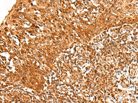 Immunohistochemistry of paraffin-embedded Human tonsil tissue using ADRM1 Polyclonal Antibody at dilution of 1:30 (×200)