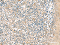 Immunohistochemistry of paraffin-embedded Human tonsil tissue using TTLL1 Polyclonal Antibody at dilution of 1:90 (×200)