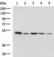 Western blot analysis of HepG2 NIH/3T3 C2CL2 Raji and Jurkat cell lysates using ENO3 Polyclonal Antibody at dilution of 1:1000