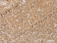 Immunohistochemistry of paraffin-embedded Human tonsil tissue using PSMD12 Polyclonal Antibody at dilution of 1:50 (×200)