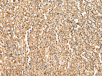 Immunohistochemistry of paraffin-embedded Human tonsil tissue using PPM1G Polyclonal Antibody at dilution of 1:35 (×200)