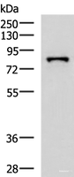Western blot analysis of HepG2 cell lysate using PRPF3 Polyclonal Antibody at dilution of 1:2000