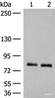 Western blot analysis of Rat brain tissue and Mouse brain tissue lysates using NGEF Polyclonal Antibody at dilution of 1:250