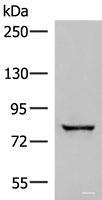 Western blot analysis of Human bladder transitional cell carcinoma grade 2-3 tissue lysate using TTC12 Polyclonal Antibody at dilution of 1:300