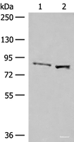 Western blot analysis of Human hepatocellular carcinoma tissue and HepG2 cell lysates using SLC26A3 Polyclonal Antibody at dilution of 1:250