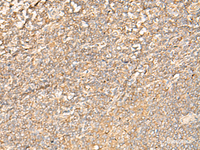 Immunohistochemistry of paraffin-embedded Human tonsil tissue using EIF3C Polyclonal Antibody at dilution of 1:35 (×200)