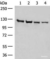 Western blot analysis of Human fetal brain tissue K562 cell Hela and A172 cell lysates using IPO11 Polyclonal Antibody at dilution of 1:450