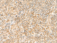 Immunohistochemistry of paraffin-embedded Human tonsil tissue using EMC1 Polyclonal Antibody at dilution of 1:35 (×200)