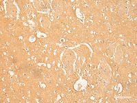 Immunohistochemistry of paraffin-embedded Human brain tissue using RNASE4 Polyclonal Antibody at dilution of 1:45 (×200)