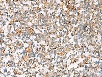 Immunohistochemistry of paraffin-embedded Human tonsil tissue using NPC2 Polyclonal Antibody at dilution of 1:50 (×200)