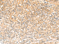 Immunohistochemistry of paraffin-embedded Human tonsil tissue using UBD Polyclonal Antibody at dilution of 1:50 (×200)