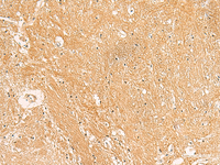 Immunohistochemistry of paraffin-embedded Human brain tissue using TXNDC12 Polyclonal Antibody at dilution of 1:50 (×200)