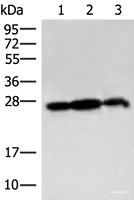 Western blot analysis of 293T cell and Rat brain tissue lysates using PDAP1 Polyclonal Antibody at dilution of 1:400