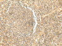 Immunohistochemistry of paraffin-embedded Human tonsil tissue using DHFR Polyclonal Antibody at dilution of 1:50 (×200)