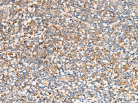 Immunohistochemistry of paraffin-embedded Human tonsil tissue using SEC22B Polyclonal Antibody at dilution of 1:70 (×200)