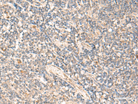 Immunohistochemistry of paraffin-embedded Human tonsil tissue using MOB1A Polyclonal Antibody at dilution of 1:50 (×200)