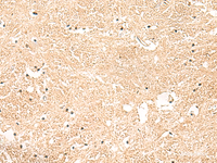 Immunohistochemistry of paraffin-embedded Human brain tissue using GSTK1 Polyclonal Antibody at dilution of 1:50 (×200)