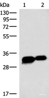 Western blot analysis of HepG2 cell Mouse heart tissue lysates using HCCS Polyclonal Antibody at dilution of 1:4000