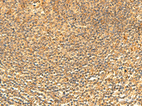 Immunohistochemistry of paraffin-embedded Human tonsil tissue using ABHD10 Polyclonal Antibody at dilution of 1:50 (×200)